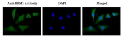Anti-RRM1 antibody used in Immunocytochemistry/ Immunofluorescence (ICC/IF). GTX00883