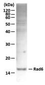 Anti-UBE2A + UBE2B antibody used in Western Blot (WB). GTX00885