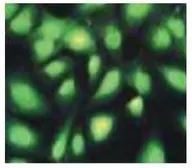 Anti-UBE2A + UBE2B antibody used in Immunocytochemistry/ Immunofluorescence (ICC/IF). GTX00885