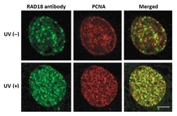 Anti-RAD18 antibody used in Immunocytochemistry/ Immunofluorescence (ICC/IF). GTX00886