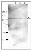 Anti-Rad21 antibody used in Western Blot (WB). GTX00890