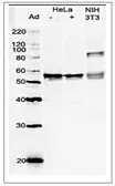 Anti-GRWD1 antibody used in Western Blot (WB). GTX00895