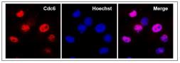 Anti-CDC6 antibody used in Immunocytochemistry/ Immunofluorescence (ICC/IF). GTX00896