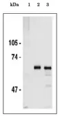 Anti-CDC6 antibody used in Immunoprecipitation (IP). GTX00896