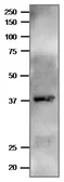 Anti-Plasmodium falciparum FNR antibody used in Western Blot (WB). GTX00910