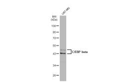 Anti-C/EBP beta antibody [GT1145] used in Western Blot (WB). GTX00915