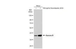 Anti-Aurora B antibody [GT1146] used in Western Blot (WB). GTX00916