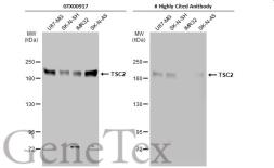 Anti-TSC2 antibody [GT1147] used in Western Blot (WB). GTX00917