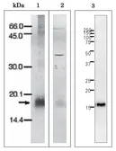 Anti-Plasmodium falciparum Ferredoxin antibody used in Western Blot (WB). GTX00920