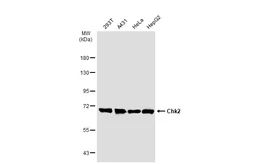Anti-Chk2 antibody [GT1148] used in Western Blot (WB). GTX00927