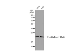 Anti-Ferritin Heavy Chain antibody [GT1149] used in Western Blot (WB). GTX00928