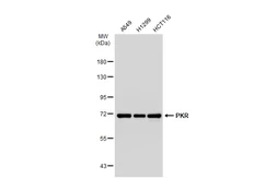 Anti-PKR antibody [GT1150] used in Western Blot (WB). GTX00929