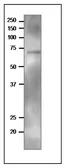 Anti-TGG2 / Myrosinase 2 antibody used in Western Blot (WB). GTX00933