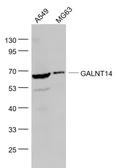 Anti-GALNT14 antibody used in Western Blot (WB). GTX00937