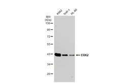 Anti-ERK2 antibody [GT1183] used in Western Blot (WB). GTX00945