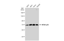 Anti-NFkB p65 antibody [GT1185] used in Western Blot (WB). GTX00947
