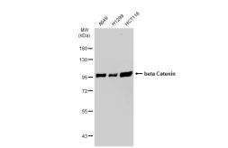 Anti-beta Catenin antibody [GT1186] used in Western Blot (WB). GTX00948