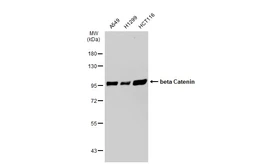 Anti-beta Catenin antibody [GT1186] used in Western Blot (WB). GTX00948