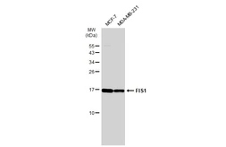 Anti-FIS1 antibody [GT1188] used in Western Blot (WB). GTX00950