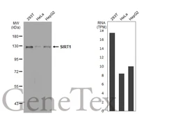 Anti-SIRT1 antibody [GT1189] used in Western Blot (WB). GTX00951