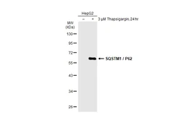 Anti-SQSTM1 / P62 antibody [GT1193] used in Western Blot (WB). GTX00955