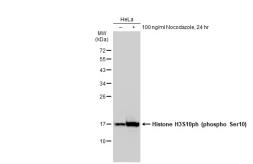 Anti-Histone H3S10ph (phospho Ser10) antibody [GT1195] used in Western Blot (WB). GTX00957