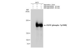 Anti-EGFR (phospho Tyr1068) antibody [GT1196] used in Western Blot (WB). GTX00958