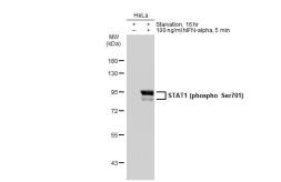 Anti-STAT1 (phospho Tyr701) antibody [GT1197] used in Western Blot (WB). GTX00959