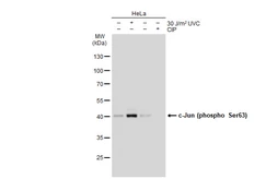 Anti-c-Jun (phospho Ser63) antibody [GT1198] used in Western Blot (WB). GTX00960