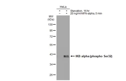 Anti-IKB alpha (phospho Ser32) antibody [GT1205] used in Western Blot (WB). GTX00967