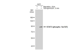 Anti-STAT3 (phospho Ser727) antibody [GT1206] used in Western Blot (WB). GTX00968