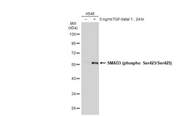 Anti-SMAD3 (phospho Ser423/Ser425) antibody [GT1207] used in Western Blot (WB). GTX00969