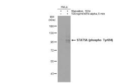 Anti-STAT5A (phospho Tyr694) antibody [GT1208] used in Western Blot (WB). GTX00970