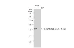 Anti-GSK3 beta (phospho Ser9) antibody [GT1209] used in Western Blot (WB). GTX00971