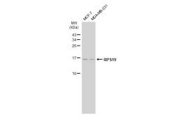 Anti-RPS19 antibody [JU33-43] used in Western Blot (WB). GTX00980
