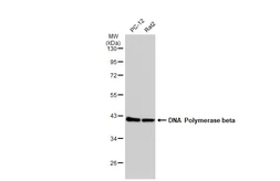 Anti-DNA polymerase beta antibody [JM93-12] used in Western Blot (WB). GTX00983