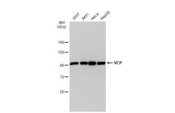 Anti-VCP antibody [JM11-15] used in Western Blot (WB). GTX00999