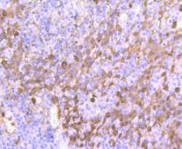 Anti-S100A9 antibody [JF096-8] used in IHC (Paraffin sections) (IHC-P). GTX01011