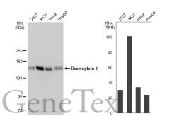 Anti-Desmoglein 2 antibody [JB96-37] used in Western Blot (WB). GTX01017