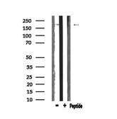 Anti-BCOR antibody used in Western Blot (WB). GTX01027