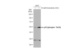 Anti-p53 (phospho Thr55) antibody [ST0439] used in Western Blot (WB). GTX01030