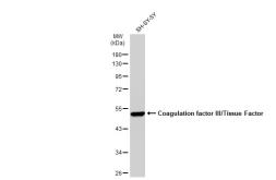 Anti-Coagulation factor III/Tissue Factor antibody [SN20-16] used in Western Blot (WB). GTX01033