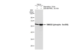 Anti-SMAD2 (phospho Ser250) antibody [SD207-1] used in Western Blot (WB). GTX01034
