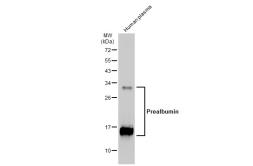 Anti-Prealbumin antibody [JM11-43] used in Western Blot (WB). GTX01035