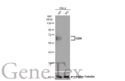 Anti-GBA antibody [JM10-76] used in Western Blot (WB). GTX01038