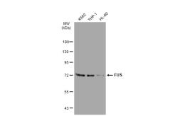 Anti-FUS antibody [JJ09-31] used in Western Blot (WB). GTX01039