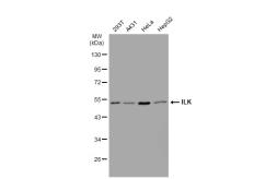 Anti-ILK antibody [SC68-04] used in Western Blot (WB). GTX01046
