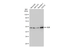 Anti-ILK antibody [SC68-04] used in Western Blot (WB). GTX01046