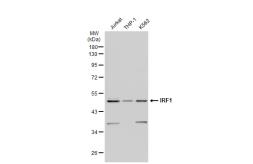 Anti-IRF1 antibody [SR44-08] used in Western Blot (WB). GTX01047