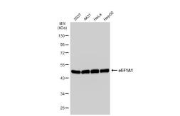 Anti-eEF1A1 antibody [JB44-13] used in Western Blot (WB). GTX01048